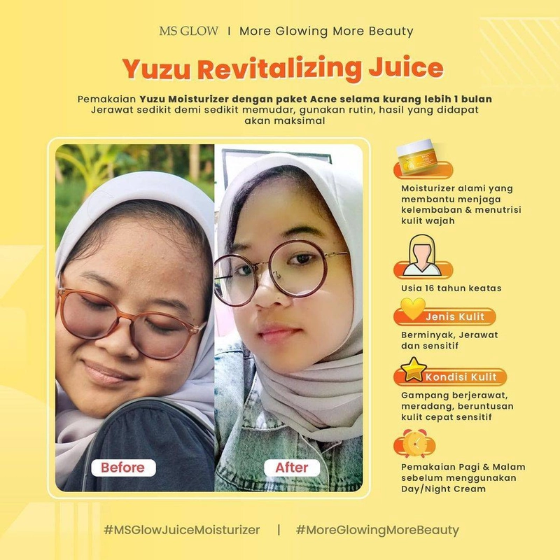 Product image MS Glow Purwakarta - Yuzu Revitalizing Juice Moisturizer 30gr Yuzu