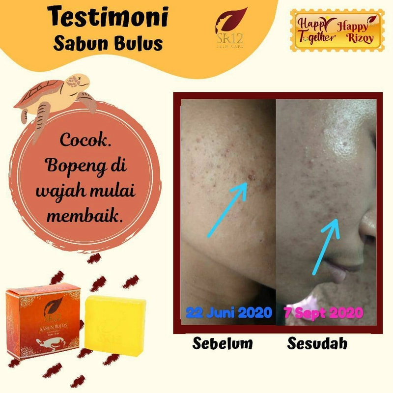 Product image SR12 Herbal Skincare - Sabun Bulus 60g Batang