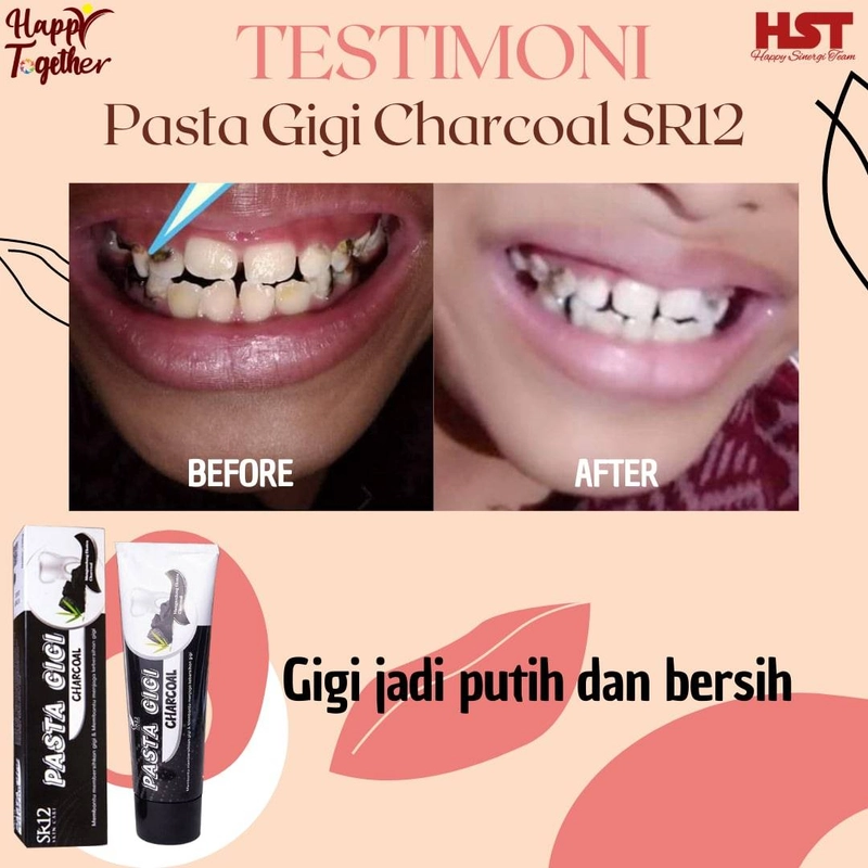 Product image SR12 Herbal Skincare - Pasta Gigi Odol 100g Charcoal