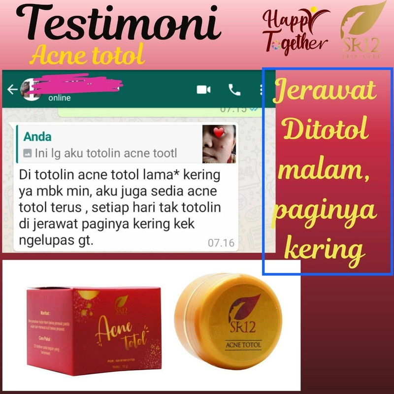 Product image SR12 Herbal Skincare - Acne Totol 10gr Obat Jerawat Kemasan Tube