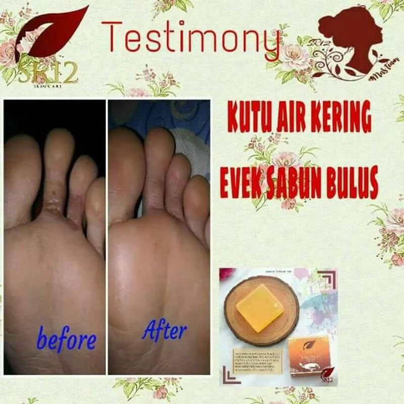 Product image SR12 Herbal Skincare - Sabun Bulus 60g Batang