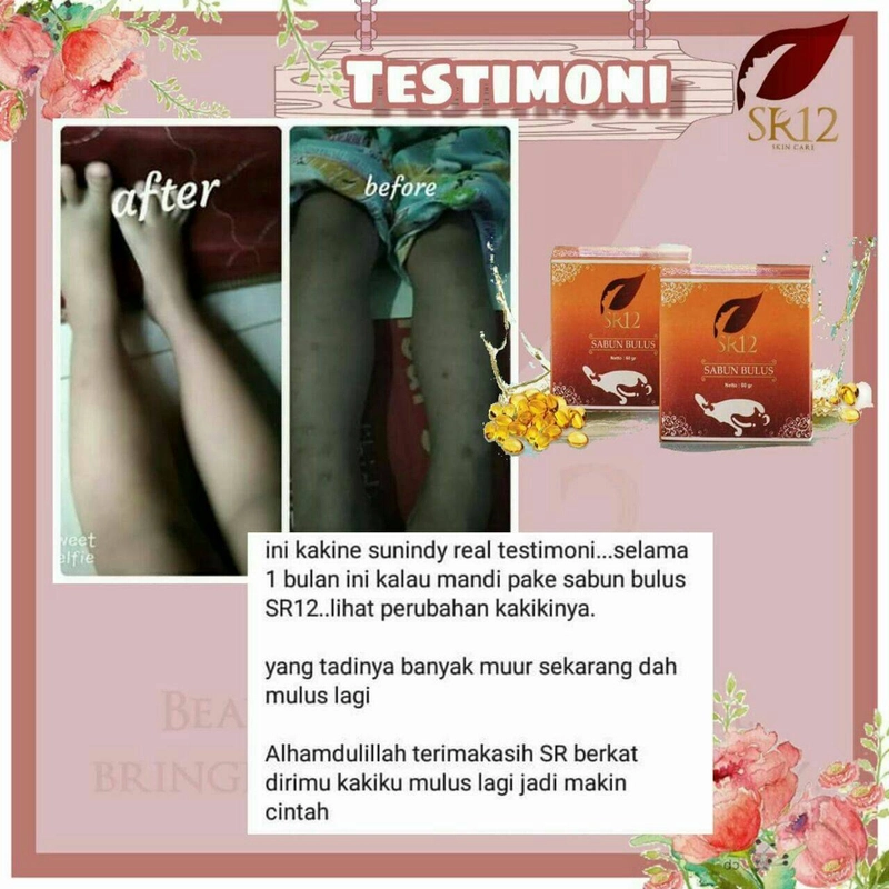 Product image SR12 Herbal Skincare - Sabun Bulus 60g Batang
