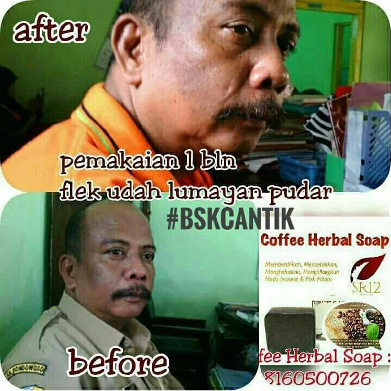 Product image SR12 Herbal Skincare - Coffee Herbal Soap 60gr Bar