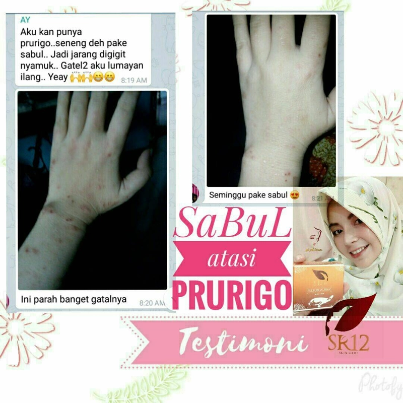 Product image SR12 Herbal Skincare - Sabun Bulus 60g Batang