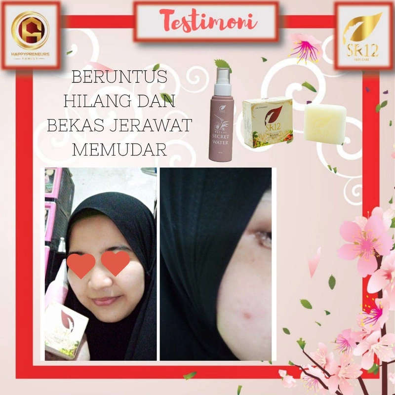 Product image SR12 Herbal Skincare - Rice Soap 60gr Batang