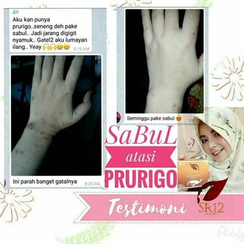 Product image SR12 Herbal Skincare - Sabun Bulus Batang 60g