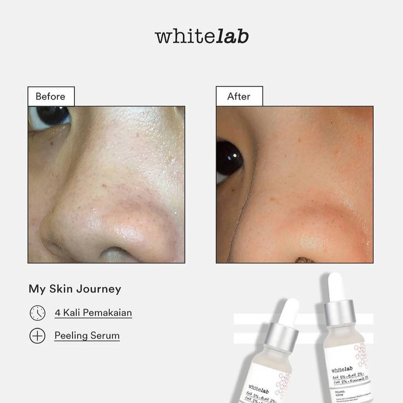 Product image Whitelab Bali - Whitelab Peeling  Serum 15 Ml Serum