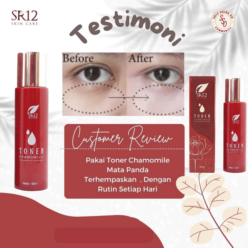 Product image Toner Chamomille Mengatasi Mata Panda Lingkar Hitam Pada Mata Mencerahkan Melembabkan Wajah TONER CHAMOMILLE