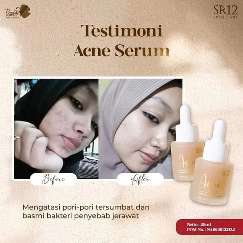 Product image Serum Jerawat BPOM Ampuh Acne Serum SR12 Mengatasi Jerawat Bruntusan Meradang ACNE SERUM SR12