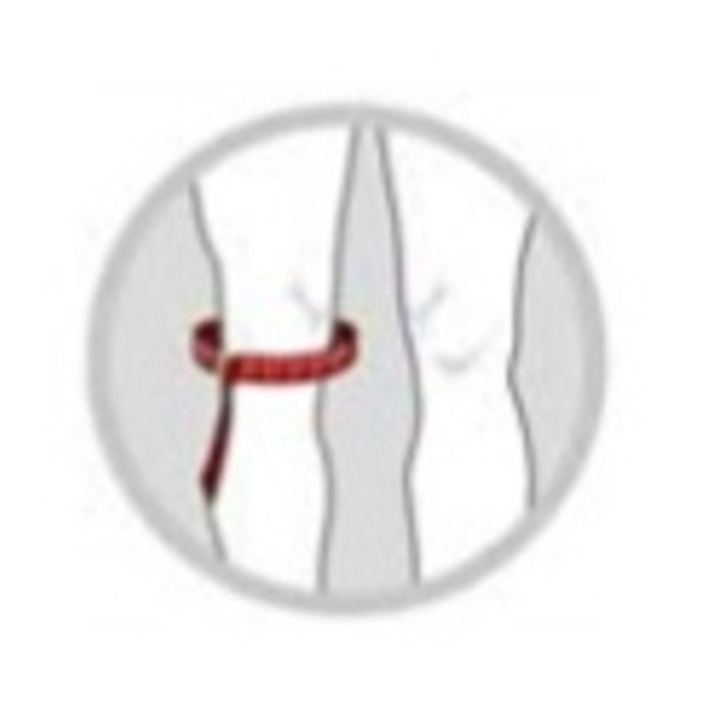 Product image LUDOZ Store - LP 272-Z LEG COMPRESSION SLEEVE EMBIOZ support 272Z Deker kaki lutut UKURAN S