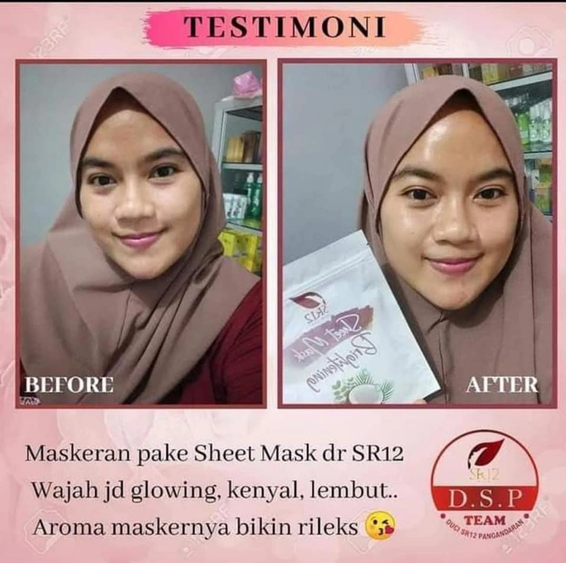 Product image Sheet Mask Brightening SR12 Masker Topeng Masker Mencerahkan Wajah Melembabkan Kulit 5 Sheets Brightening