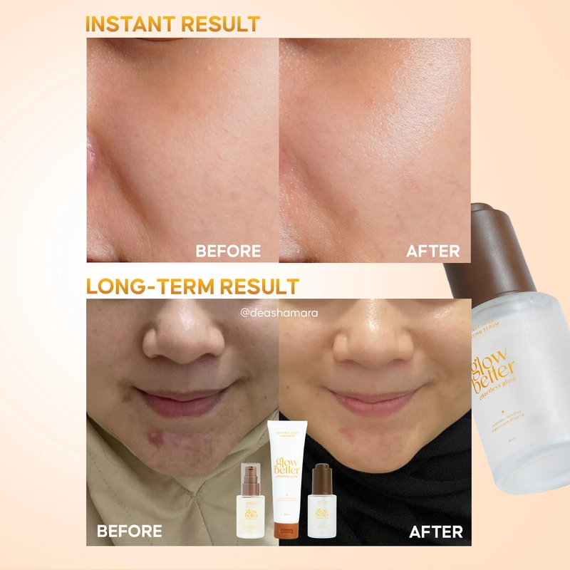 Product image Glow Better - Effortless Glow Coconut Juice Hydrating Serum 30 ml Serum