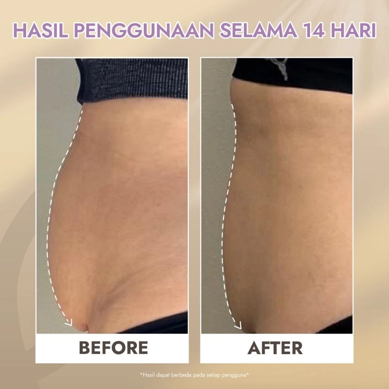 Product image Seolmi - SEOLMI Slimming Body Serum 50ml putih gel