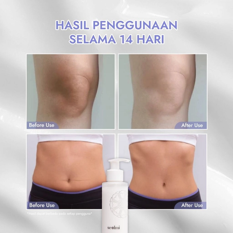 Product image Seolmi - SEOLMI Whitening Body Lotion 150ml putih