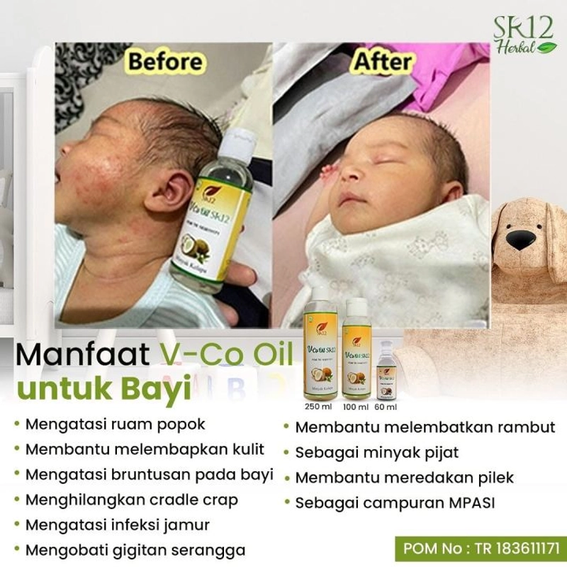 Product image SR12 VCO Minyak Kelapa Murni Mengatasi Ruam Iritasi 60 ml VCO Cair
