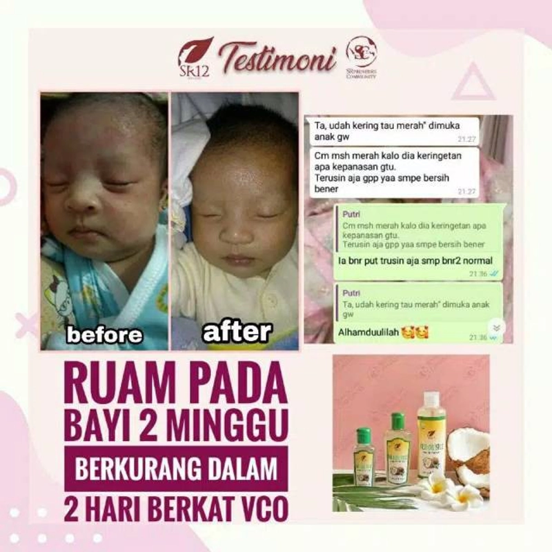 Product image SR12 VCO Minyak Kelapa Murni Mengatasi Ruam Iritasi 60 ml VCO Cair