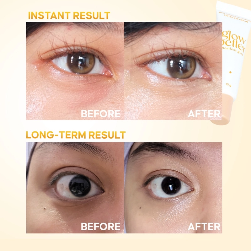 Product image Glow Better - Effortless Glow Best Version of Your Skin Tinted Eye Cream 10 g Serum