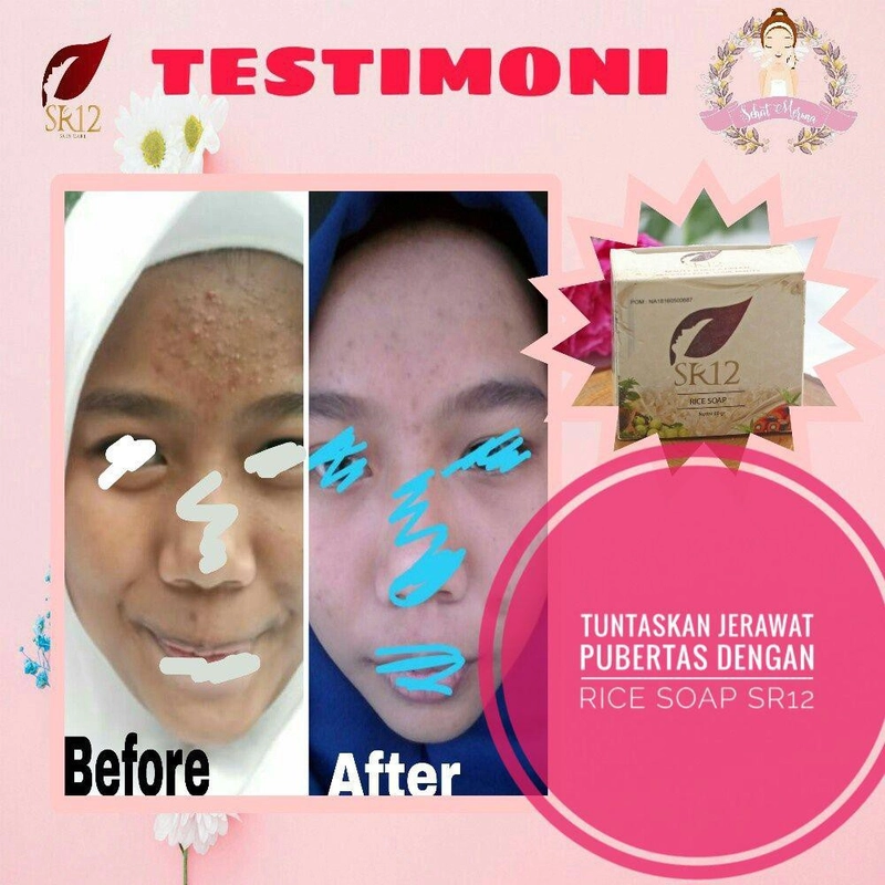 Product image SR12 Rice Soap Mengontrol Minyak Berlebih Di Wajah Dan Mengatasi Jerawat Dengan Kandungan Beras 60 gr Rice Soap