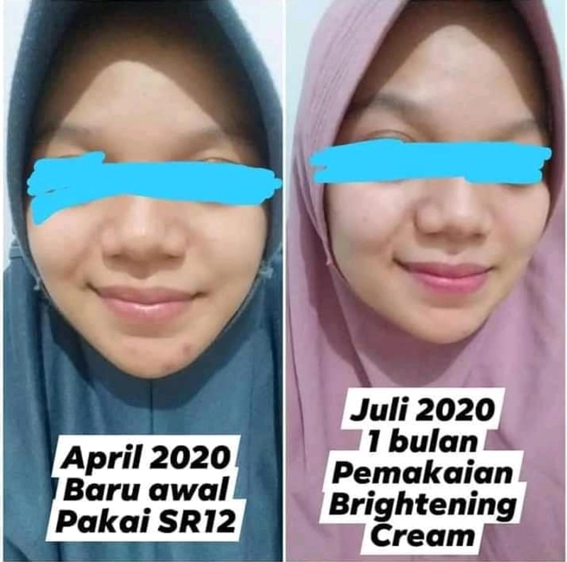 Product image SR12 Brightening Cream Day Dan Night Mencerahkan Kulit 10gr Night
