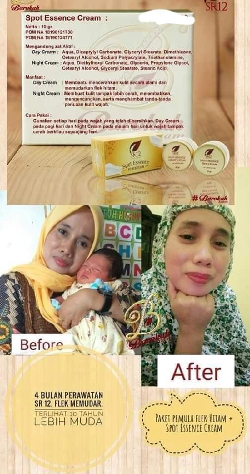 Product image SR12 Spot Cream Essence Day Dan Night Memudarkan Flek Hitam 10 gr Night