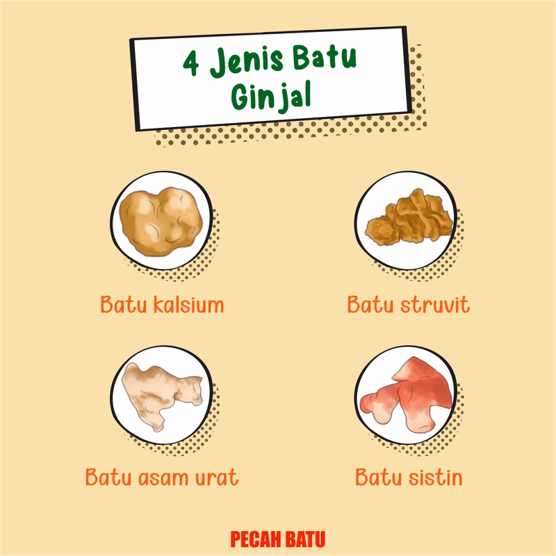 Product image PECAH BATU Obat Batu Ginjal Sakit Pinggang Penghacur Batu Ginjal Infeksi Saluran Kemih Kencing BPOM 60 kapsul Herbal