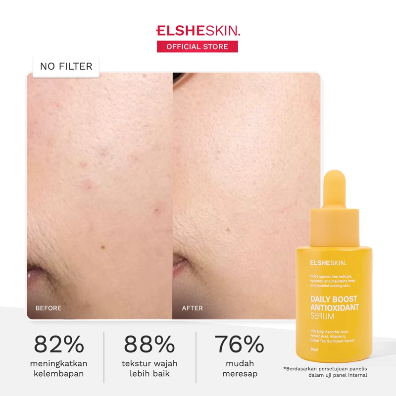 Product image ELSHESKIN - ElsheSkin Daily Boost Antioxidant Serum 15ml 15ml 15% Vitamin C