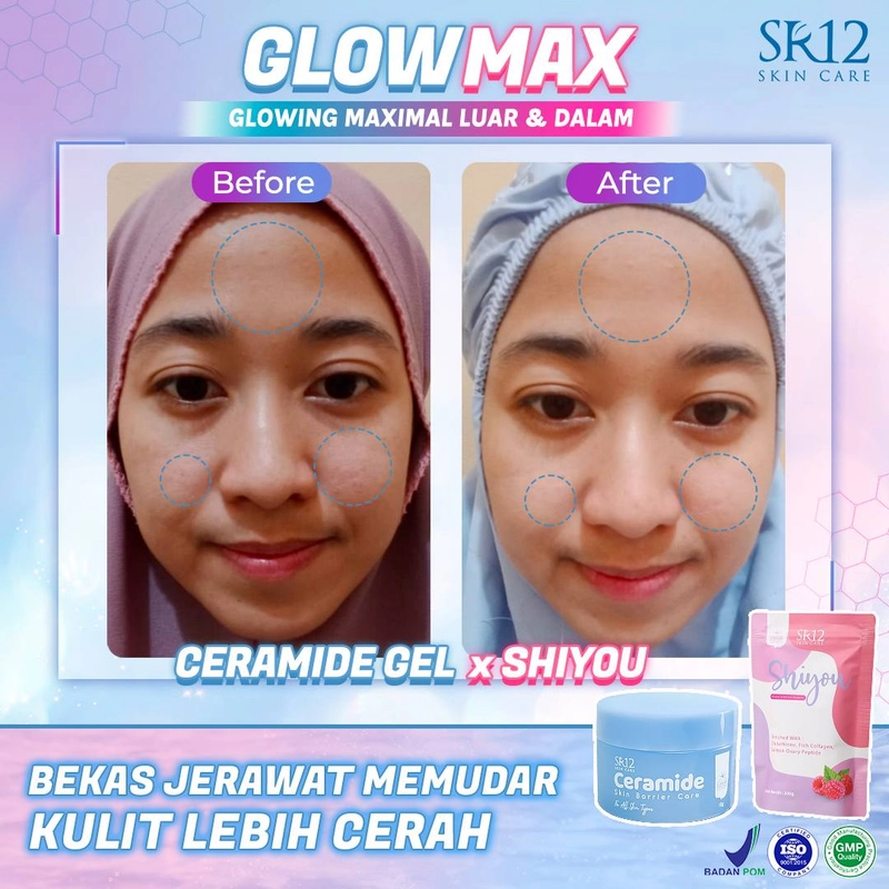 Product image SR12 Ceramide Gel Pelembab Untuk Memperbaiki Skin Barrier Dan Mengatasi Jerawat 18gr Ceramide