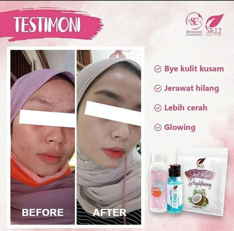 Product image Sheet Mask Brightening SR12 Masker Topeng Masker Mencerahkan Wajah Melembabkan Kulit 5 Sheets Brightening