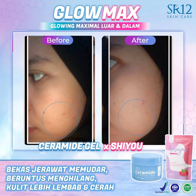Product image SR12 Ceramide Gel Pelembab Untuk Memperbaiki Skin Barrier Dan Mengatasi Jerawat 18gr Ceramide
