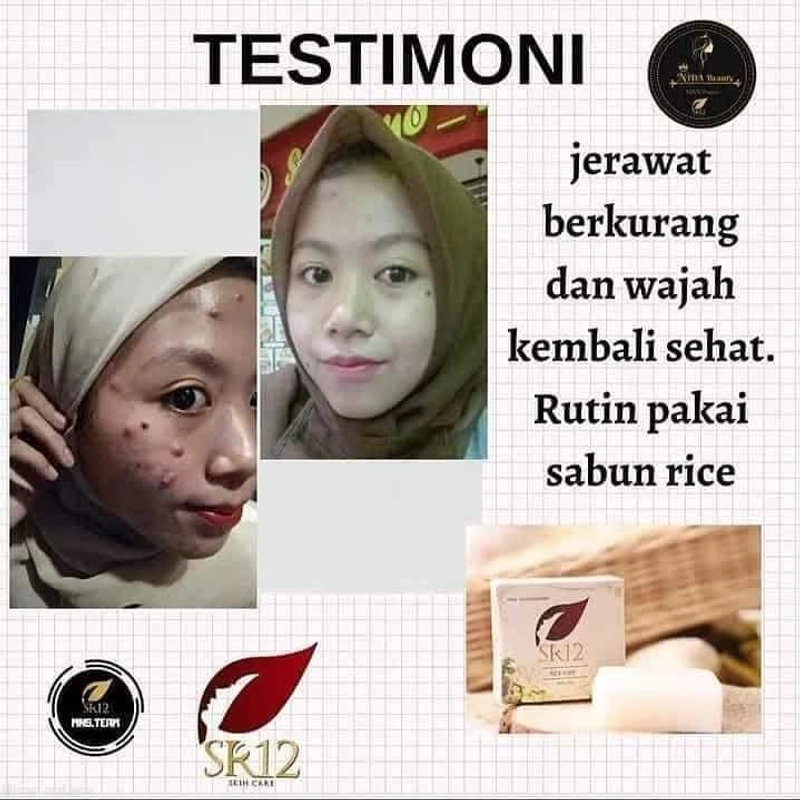 Product image SR12 Rice Soap Mengontrol Minyak Berlebih Di Wajah Dan Mengatasi Jerawat Dengan Kandungan Beras 60 gr Rice Soap