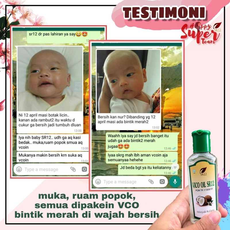 Product image SR12 VCO Minyak Kelapa Murni Mengatasi Ruam Iritasi 60 ml VCO Cair