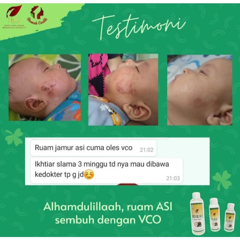 Product image SR12 VCO Minyak Kelapa Murni Mengatasi Ruam Iritasi 60 ml VCO Cair