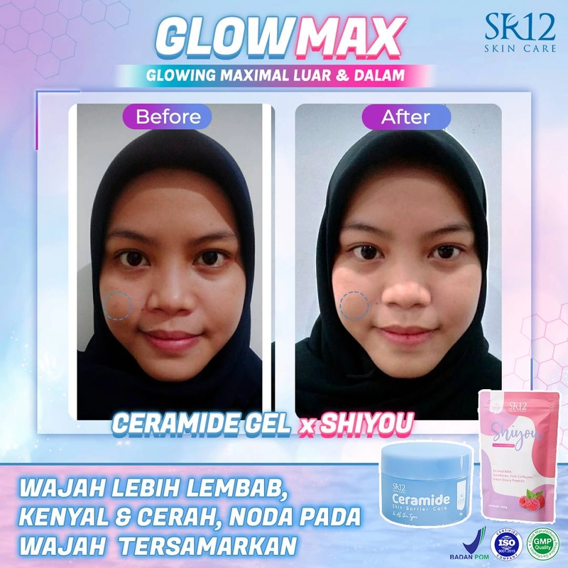 Product image SR12 Ceramide Gel Pelembab Untuk Memperbaiki Skin Barrier Dan Mengatasi Jerawat 18gr Ceramide