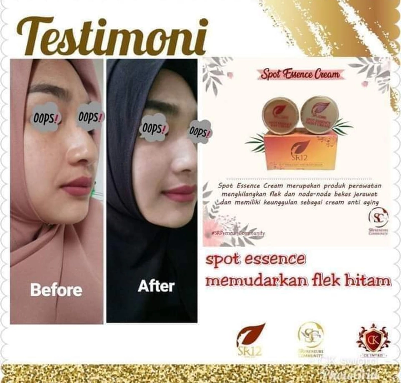Product image SR12 Spot Cream Essence Day Dan Night Memudarkan Flek Hitam 10 gr Night