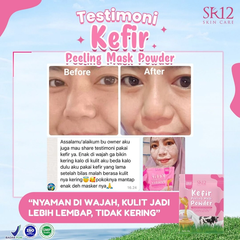 Product image SR12 Kefir Peeling Mask Powder Mengeksfoliasi Sel Kulit Mati 50g Kefir Mask