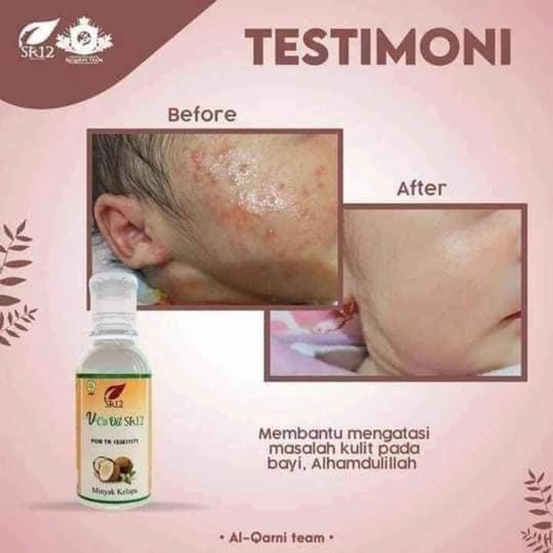 Product image SR12 VCO Minyak Kelapa Murni Mengatasi Ruam Iritasi 60 ml VCO Cair