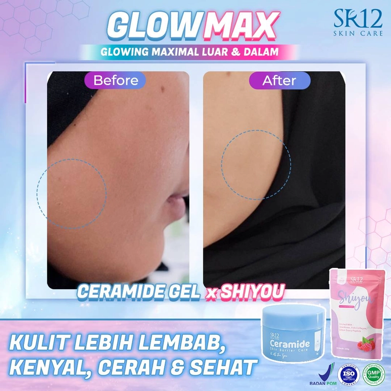 Product image SR12 Ceramide Gel Pelembab Untuk Memperbaiki Skin Barrier Dan Mengatasi Jerawat 18gr Ceramide