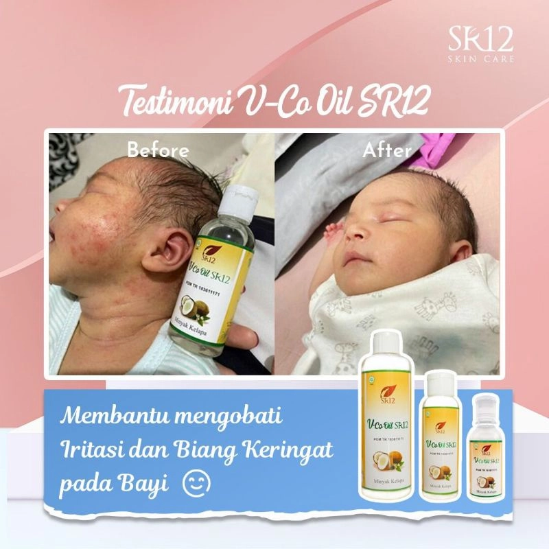 Product image SR12 VCO Minyak Kelapa Murni Mengatasi Ruam Iritasi 60 ml VCO Cair