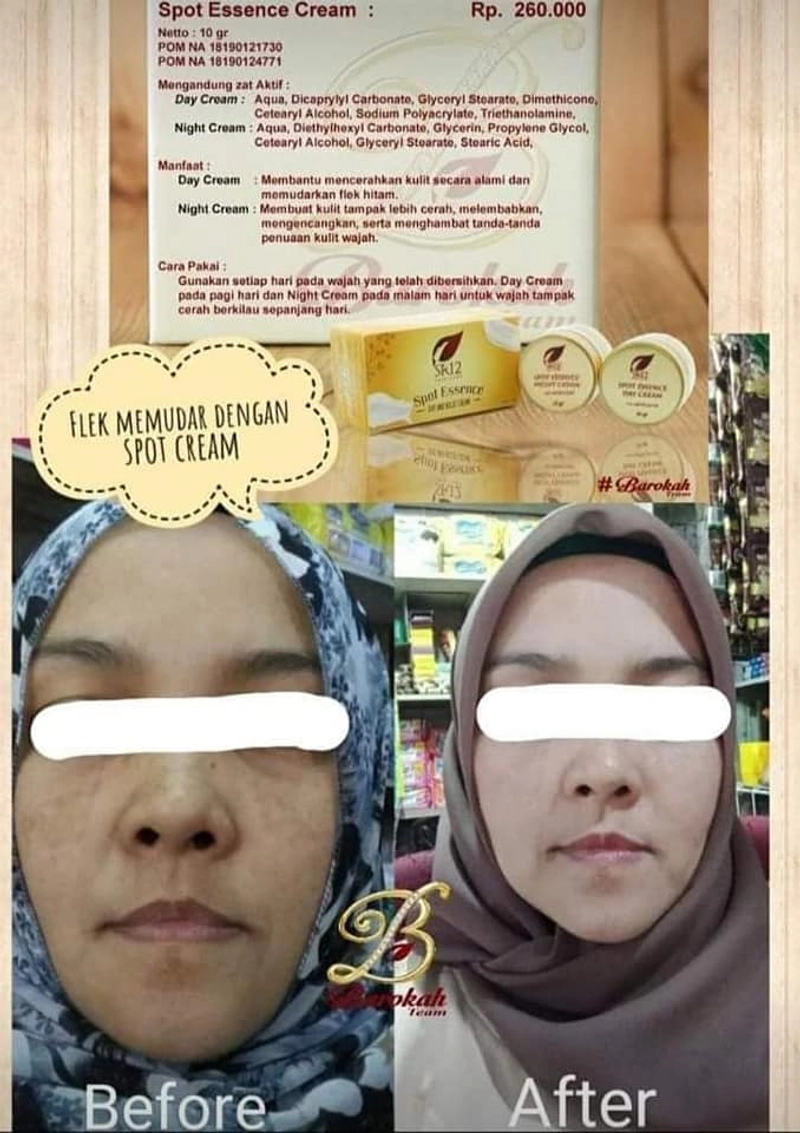 Product image SR12 Spot Cream Essence Day Dan Night Memudarkan Flek Hitam 10 gr Night
