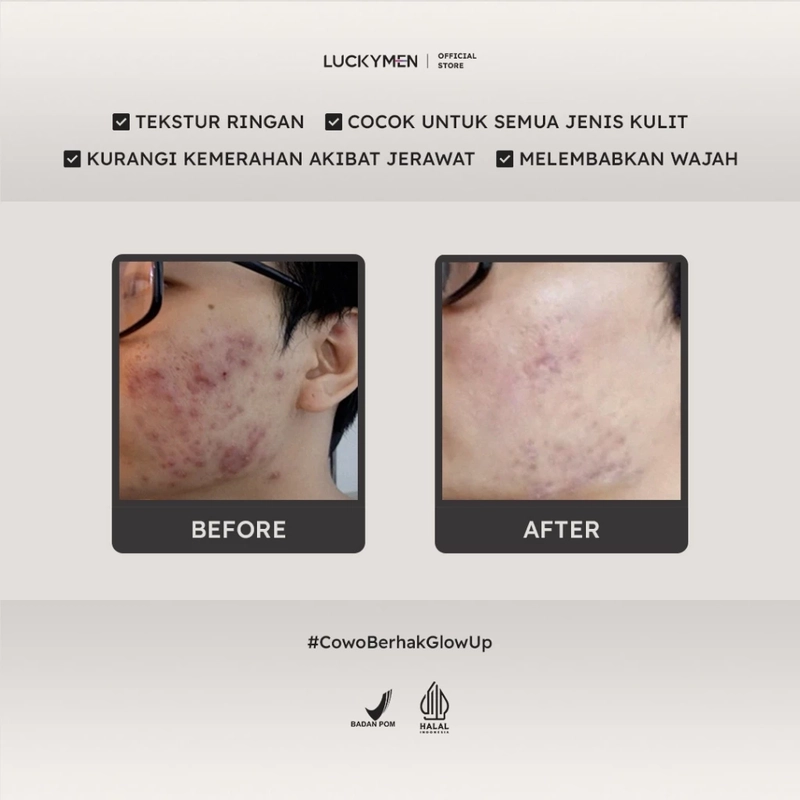 Product image Luckymen - Cica Moist Revitalize 25gr Hitam