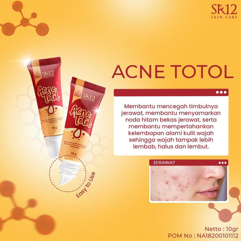 Product image Acne Totol Mengeringkan Jerawat Melembabkan Kulit Menyamarkan Bekas Jerawat 10 gr Acne Totol