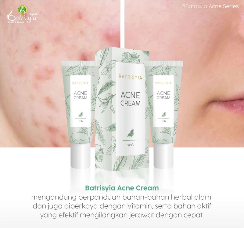 Product image Batrisyia Acne Cream / Totol Acne 9 gr Acne Cream