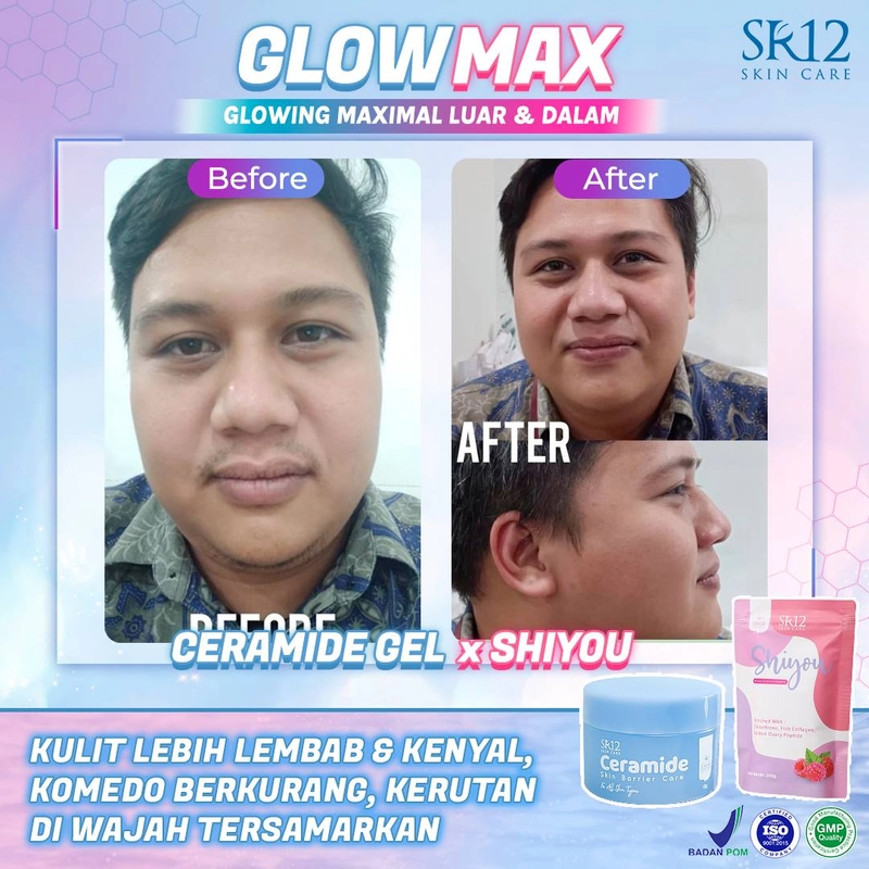 Product image SR12 Ceramide Gel Pelembab Untuk Memperbaiki Skin Barrier Dan Mengatasi Jerawat 18gr Ceramide