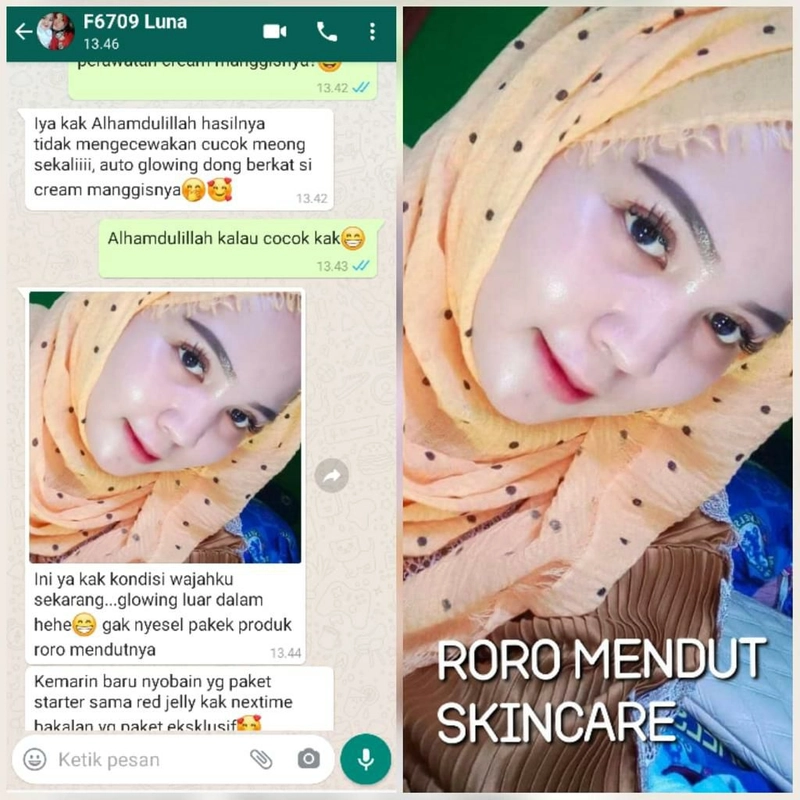 Product image Roro Mendut Skincare - Paket Cream Kulit Manggis Atasi Flek Hitam 3pcs Paket Starter