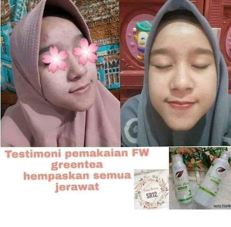 Product image SR12 Facial Wash Greentea Mengatasi Kulit Berminyak Berjerawat 100 ml Facial Greentea Putih