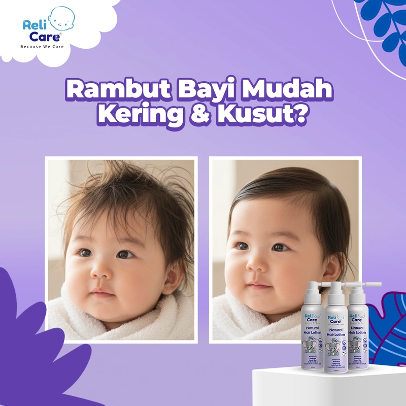 Product image RELICARE - HAIR LOTION 100ML Spray