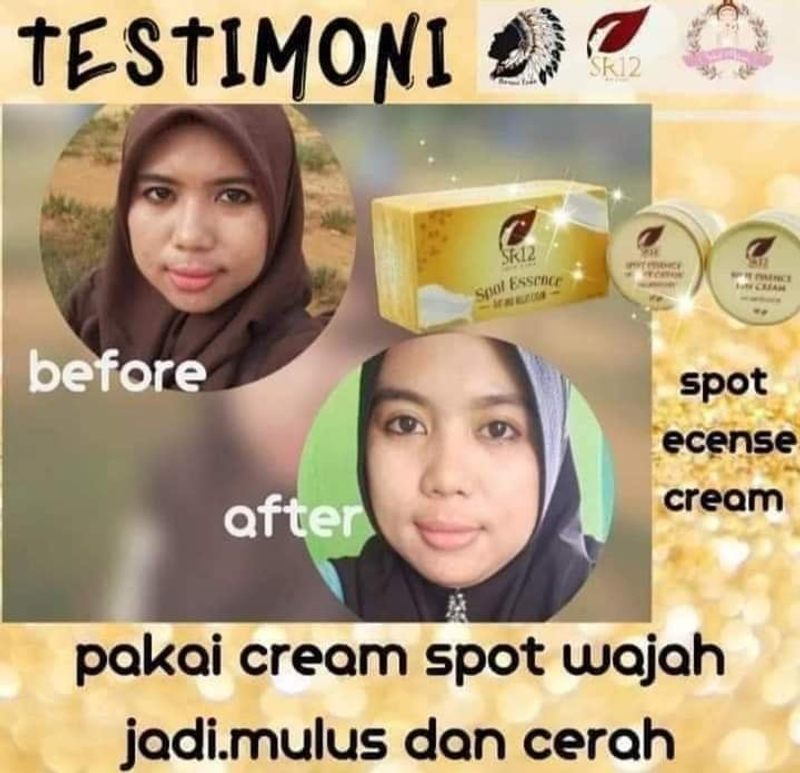 Product image SR12 Spot Cream Essence Day Dan Night Memudarkan Flek Hitam 10 gr Day