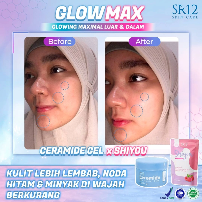 Product image SR12 Ceramide Gel Pelembab Untuk Memperbaiki Skin Barrier Dan Mengatasi Jerawat 18gr Ceramide