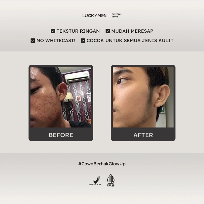 Product image Luckymen - Serum Moonlight Acne Solution 25ml Hitam