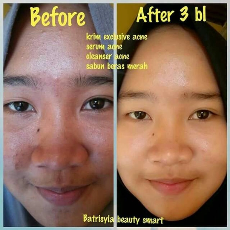 Product image Batris Facial Wash Propolis 250 gr